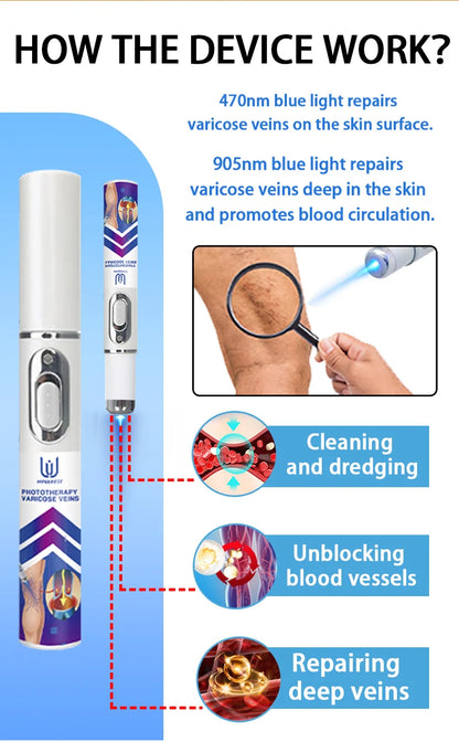 Laser Indolore Contre la Varices