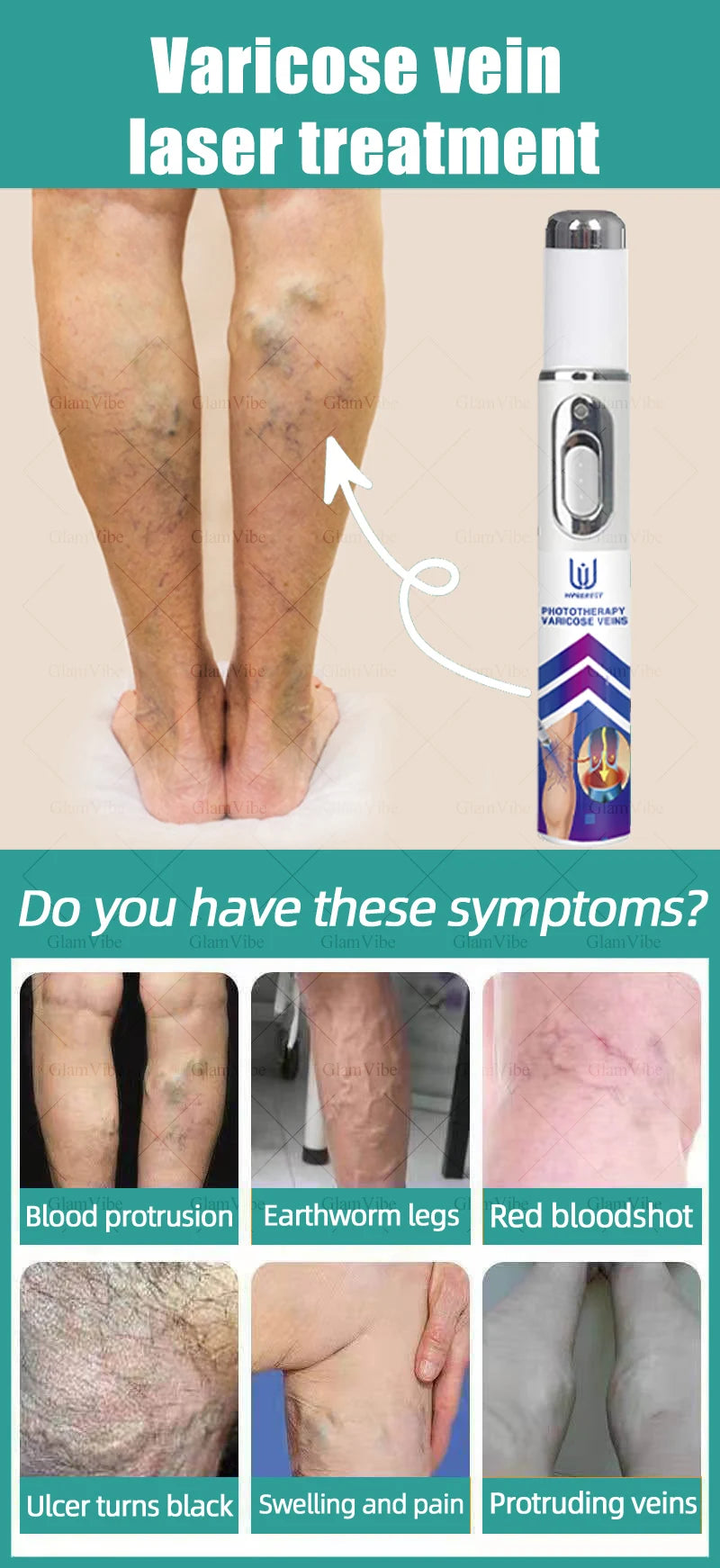 Laser Indolore Contre la Varices