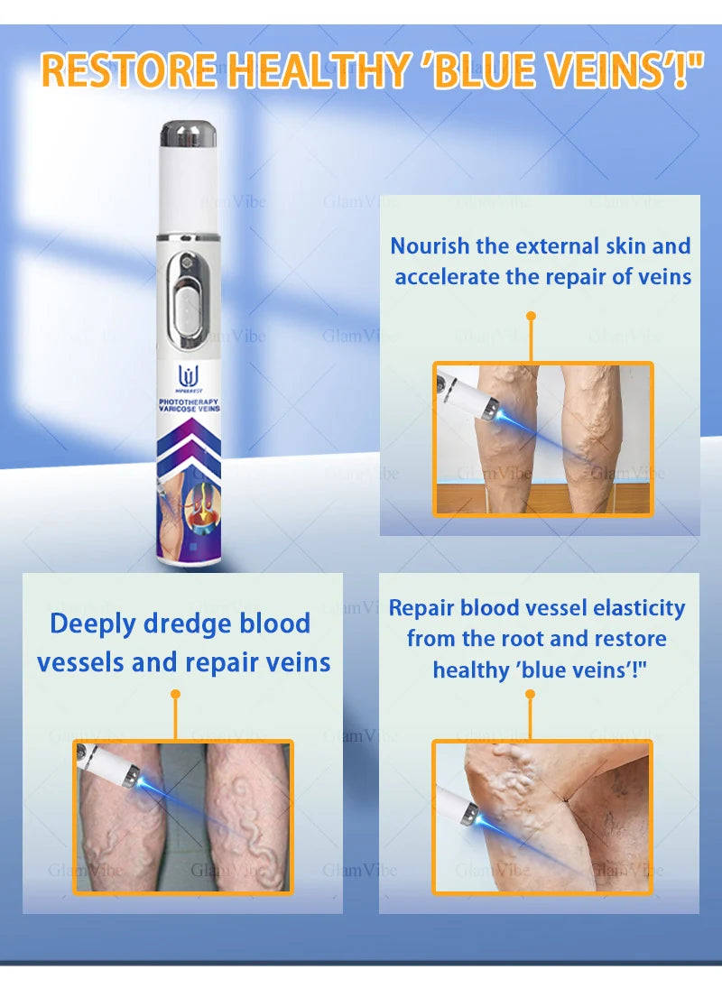 Laser Indolore Contre la Varices
