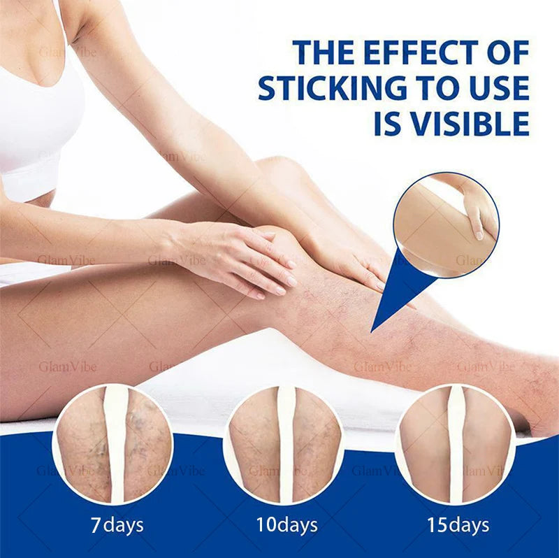 Laser Indolore Contre la Varices