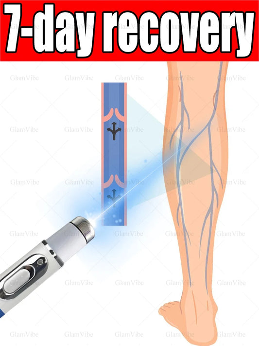 Laser Indolore Contre la Varices